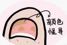 茄子這樣吃,勝過10副藥