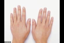 秋季手上出現3種情況別忽視，每天一杯“茶”，排出濕毒