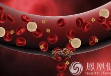 99%的血栓無征兆！記住一個字，就能遠離全身血栓