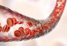 血脂一升高，五個部位會“說話”！太多人不知道