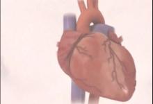 心臟病如何防患于未然? 美科學家推薦8種方法