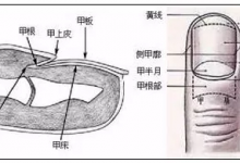 指甲發黃是肺不好？月牙少是胃有問題？指甲的6大傳言，你信了嗎？