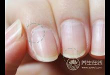 指甲出現白點、易斷裂…5狀況健康亮紅燈