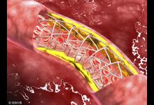 它是身體發出的“求救信號”，你了解多少？