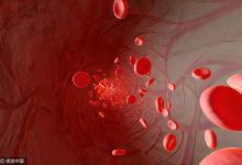 身體這些信號說明血管有問題