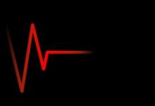 心跳每分鐘超過這個數(shù) 血管或可