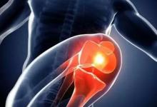 膝關節為什么會發出彈響?