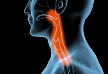 總是想清嗓子是怎么回事? 保護嗓子有絕招