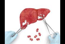 堅持這五個小習慣,養肝護肝不在話下