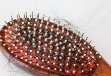 預防脫發(fā)的方法有哪些？