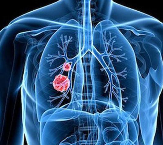 長期吃梨有潤肺止咳的功效嗎？