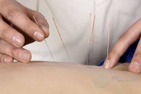 針灸減肥效果好不好呢 針灸減肥效果好不好呢