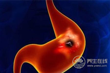 胃酸過多早餐該吃什么好 胃酸過多早餐該吃什么好