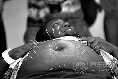 針灸養(yǎng)生 針灸減肥原理及注意事項(xiàng)