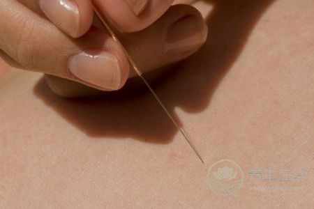 針灸減肥效果好不好呢 針灸減肥效果好不好呢