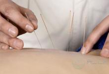 針灸減肥效果好不好呢