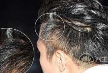 食療治白發 飲食均衡是關鍵