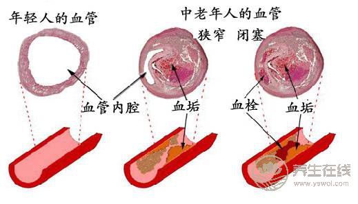 7種“換血”食物,每天吃一種身體棒棒的! 7種“換血”食物,每天吃一種身體棒棒的!