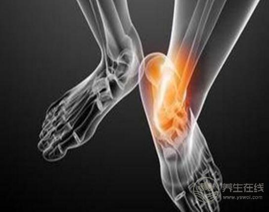 痛風病是不是不能吃這一物？