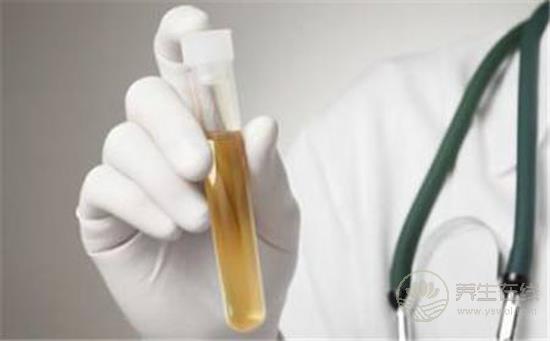 尿液發黃像濃茶？小心是肝膽出了問題！