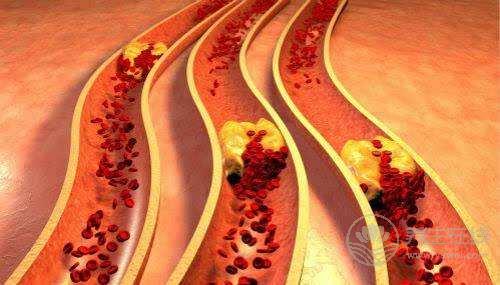 這些清理血管的特效食物，35歲以后一定要多吃