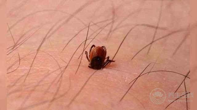 國慶出游,遇到“旅游病”怎么辦? 國慶出游,遇到“旅游病”怎么辦?