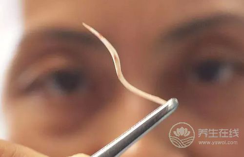 被魚刺卡了,吃飯團喝醋?錯! 被魚刺卡了,吃飯團喝醋?錯!