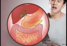 洗牙之后注意事項有哪些?