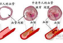 泡腳水加點姜,能有想不到的功效