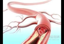 血脂高降不下來只因你沒吃這些