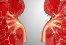 補血補氣的食物有哪些?