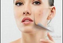 痘痘星人看過來，這3種食物咱別吃了，再好吃為了美也要忍