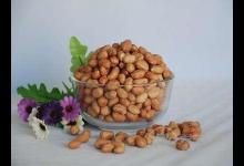 八旬老人吃紅棗心臟驟停,切忌養(yǎng)生要適當