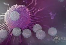 甜食是腫瘤的養料，癌細胞瘋長，癌癥很快就晚期了！