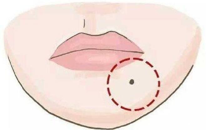 如何判別身體皮膚上長的是痣還是斑 如何判別身體皮膚上長的是痣還是斑