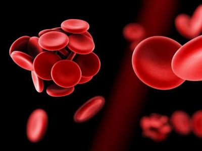 血液流速慢是什么原因要如何改善