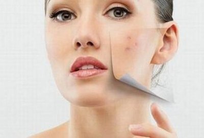 臉上長的痘痘開始發紫是什么情況 臉上長的痘痘開始發紫是什么情況