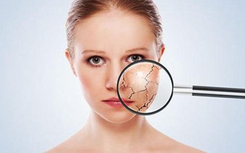 當皮膚出現干裂的情況應該如何處理 當皮膚出現干裂的情況應該如何處理