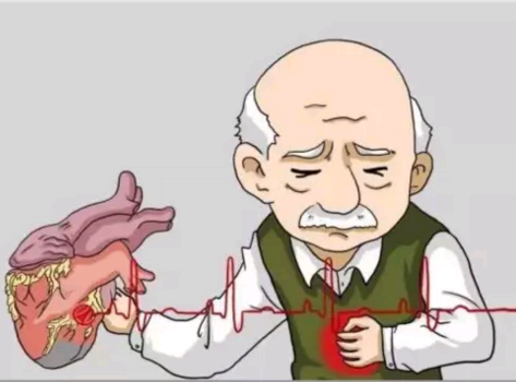 冠心病患者常見的癥狀以及吃哪些藥好