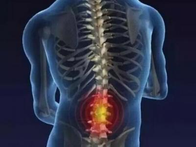 檢查腰椎是否健康要檢查哪些方面