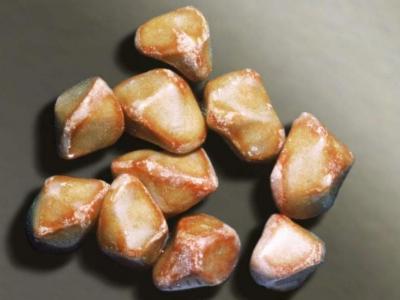 膽固醇結石要采取怎樣的方法治療