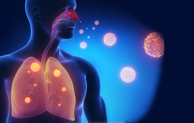 肺部功能差會有哪些表現或是癥狀 肺部功能差會有哪些表現或是癥狀