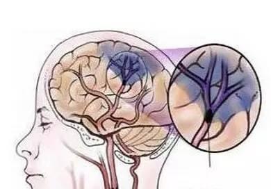 交感神經(jīng)的作用抑制興奮的有效藥物