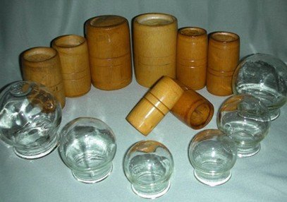 感冒時候的身體情況是否適合拔罐