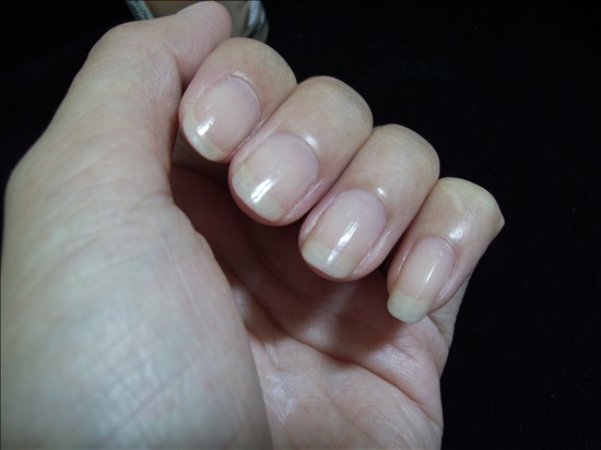 指甲的保護(hù)方法指甲豎著裂開的原因-易網(wǎng)健康<a href=http://www.jsjjzhkt.cn/jkys/ target=_blank class=infotextkey>養(yǎng)生</a>網(wǎng) 指甲的保護(hù)方法指甲豎著裂開的原因