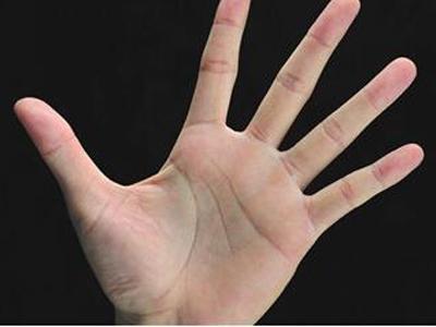 導(dǎo)致手心容易潮濕經(jīng)常出汗的原因