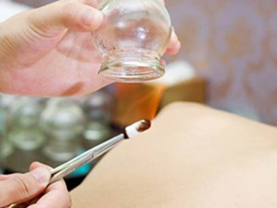 經常拔罐對身體有哪些好處和壞處-易網健康<a href=http://www.jsjjzhkt.cn/jkys/ target=_blank class=infotextkey>養生</a>網 經常拔罐對身體有哪些好處和壞處