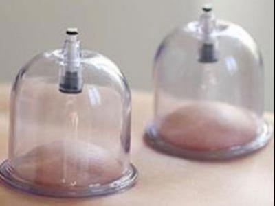 拔罐的時(shí)候身體上的哪些位置不能拔