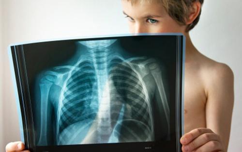 孕婦是否可以拍胸片會不會有輻射-易網健康<a href=http://www.jsjjzhkt.cn/jkys/ target=_blank class=infotextkey>養生</a>網 孕婦是否可以拍胸片會不會有輻射