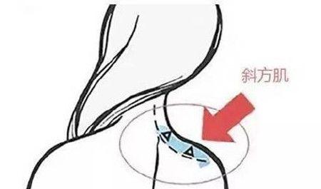 斜方肌可以通過按摩的方式消除嗎-易網健康<a href=http://www.jsjjzhkt.cn/jkys/ target=_blank class=infotextkey>養生</a>網 斜方肌可以通過按摩的方式消除嗎